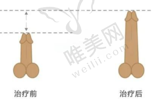 8、济南丽合整形医院详细的预约挂号方式及流程