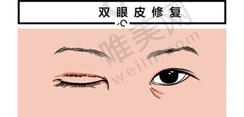 沈阳百嘉丽整形价格表公开，揭秘院内优质医生及热门项目收费详情 