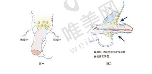 7、上海华美整形医院地址电话营业时间