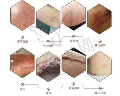杭州时光整形价格表查询，揭秘院内专家收费详情与热门项目真实报价 