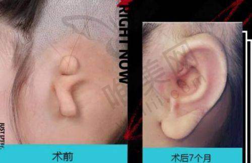 2、上海九龙医院男科是正规医院吗？
