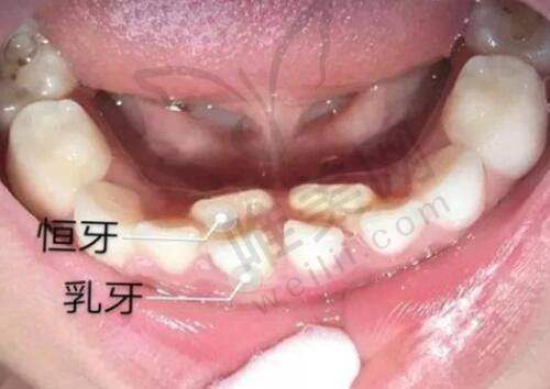 8、成都狐臭医院详细的预约挂号方式及流程