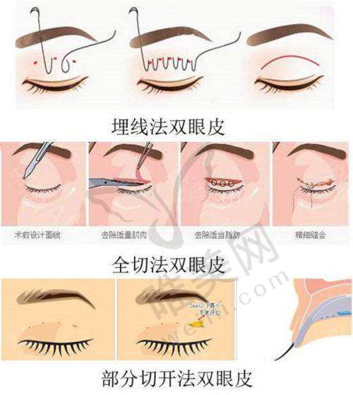 1、南宁芭芘丽医疗美容门诊怎么样？