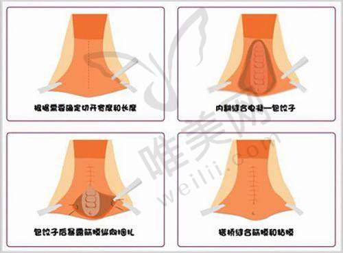 8、北京八大处整形医院详细的预约挂号方式及流程