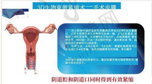 7、北京美和眼科医院地址电话营业时间