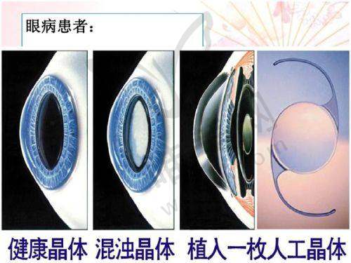 6、北京美和眼科医院收费价格表/收费标准