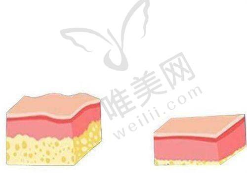 2、郑州梨花雨医疗美容门诊是正规医院吗？