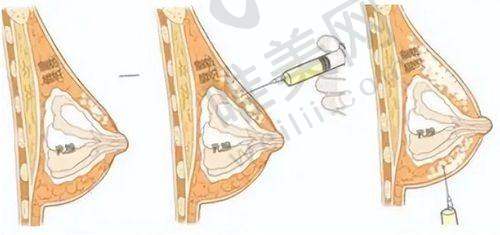 2、郑州健丽医疗美容诊所是正规医院吗？
