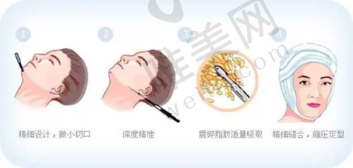 4、郑州市望京医疗美容诊所特色项目及技术优势