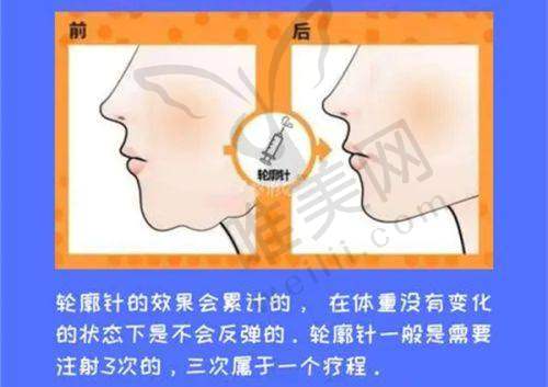 9、郑州健丽医疗美容诊所真人口碑评价怎么样？
