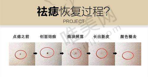 6、郑州倾颜医疗美容医院收费价格表/收费标准
