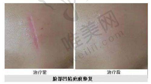 8、郑州健丽医疗美容诊所详细的预约挂号方式及流程