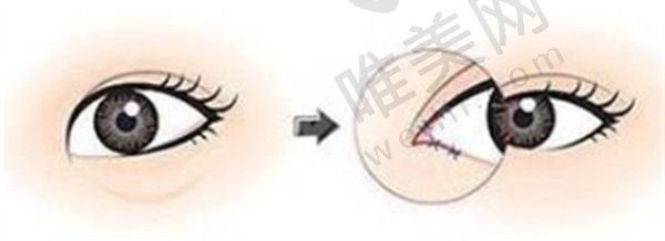 八大处医院在整形美容