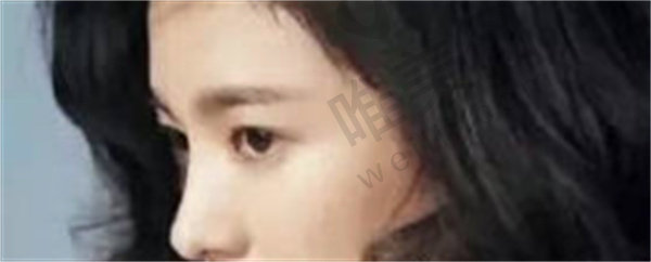 徐宇红医生的拉皮手术费用