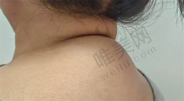 技术的具体步骤