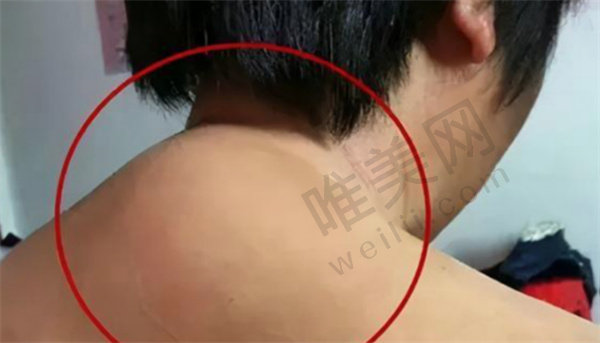 术后成效与反馈