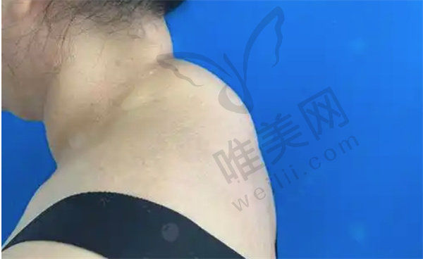 患者真实实例分享