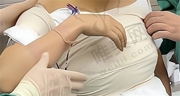 南京美莱医院张荣明做隆胸手术多少钱