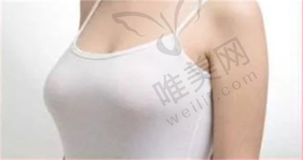 南京美莱医院张荣明做隆胸过程