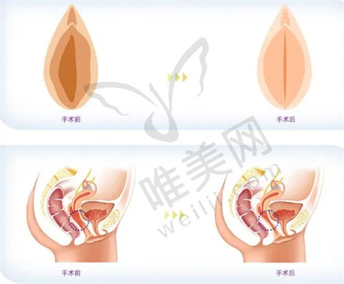 南京康美医疗美容医院做私密整形怎么样？